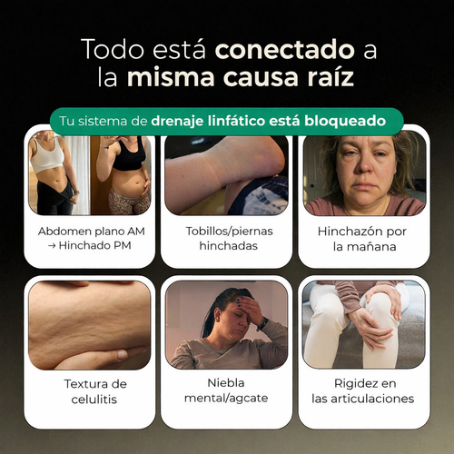 New Maximum Potency Formula - Sculpt™ Lymphatic Drainage Capsules by eskin™