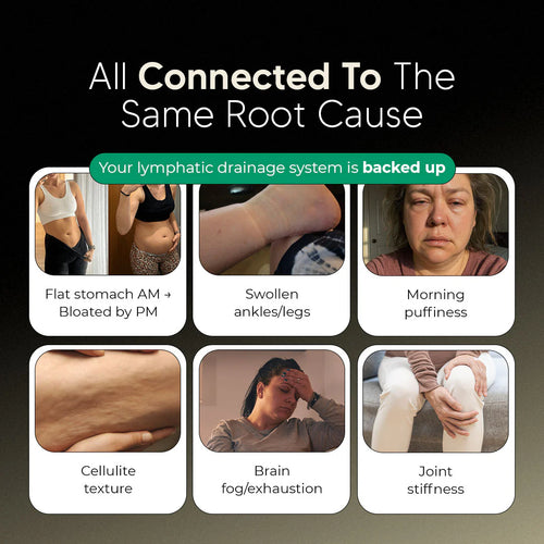 New Maximum Potency Formula - Sculpt™ Lymphatic Drainage Capsules by eskin™